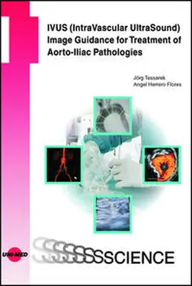 Tessarek / Herrero Flores / Teßarek |  IVUS (IntraVascular UltraSound) Image Guidance for Treatment of Aorto-Iliac Pathologies | Buch |  Sack Fachmedien