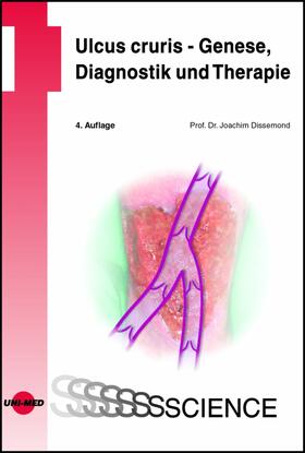 Dissemond |  Ulcus cruris - Genese, Diagnostik und Therapie | eBook | Sack Fachmedien