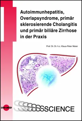 Maier |  Autoimmunhepatitis, Overlapsyndrome, primär sklerosierende Cholangitis und primär biliäre Zirrhose in der Praxis | eBook | Sack Fachmedien