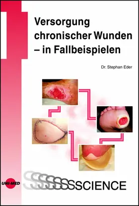 Eder |  Versorgung chronischer Wunden - in Fallbeispielen | eBook | Sack Fachmedien