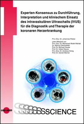 Rieber |  Experten-Konsensus zu Durchführung, Interpretation und klinischem Einsatz des intravaskulären Ultraschalls (IVUS) für die Diagnostik und Therapie der koronaren Herzerkrankung | eBook | Sack Fachmedien