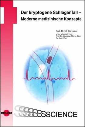 Ziemann | Der kryptogene Schlaganfall - Moderne medizinische Konzepte | E-Book | sack.de