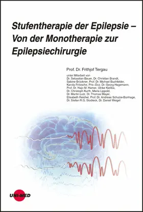 Tergau |  Stufentherapie der Epilepsie - Von der Monotherapie zur Epilepsiechirurgie | eBook | Sack Fachmedien