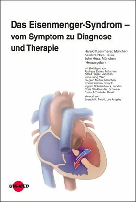 Kaemmerer / Niwa / Hess | Das Eisenmenger-Syndrom - vom Symptom zu Diagnose und Therapie | E-Book | sack.de