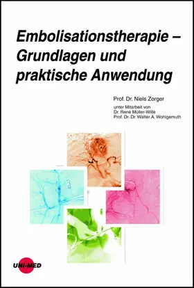 Zorger |  Embolisationstherapie - Grundlagen und praktische Anwendung | eBook | Sack Fachmedien