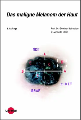 Sebastian / Stein |  Das maligne Melanom der Haut | eBook | Sack Fachmedien