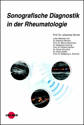 Strunk |  Sonografische Diagnostik in der Rheumatologie | eBook | Sack Fachmedien