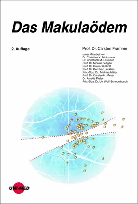 Framme |  Das Makulaödem | eBook | Sack Fachmedien