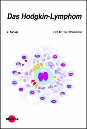 Borchmann |  Das Hodgkin-Lymphom | eBook | Sack Fachmedien