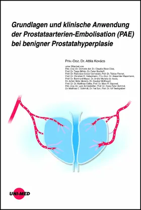 Kovács |  Grundlagen und klinische Anwendung der Prostataarterien-Embolisation (PAE) bei benigner Prostatahyperplasie | eBook | Sack Fachmedien