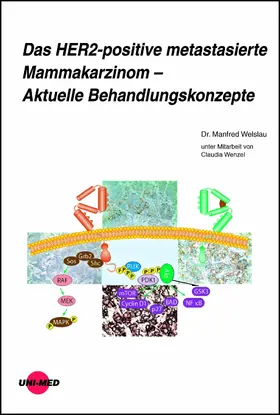 Welslau |  Das HER2-positive metastasierte Mammakarzinom - Aktuelle Behandlungskonzepte | eBook | Sack Fachmedien