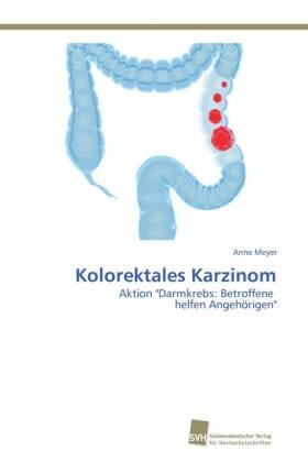 Meyer | Kolorektales Karzinom | Buch | 978-3-8381-1691-4 | sack.de