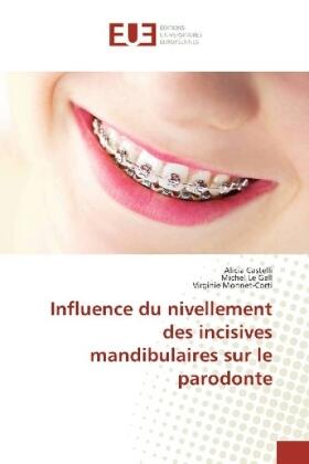 Castelli / Le Gall / Monnet-Corti |  Influence du nivellement des incisives mandibulaires sur le parodonte | Buch |  Sack Fachmedien