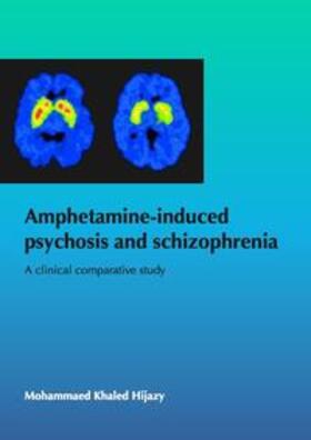 Hijazy |  Amphetamine-induced psychosis and schizophrenia: A clinical comparative study | Buch |  Sack Fachmedien