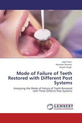 Kaur / Sharma / Singh |  Mode of Failure of Teeth Restored with Different Post Systems | Buch |  Sack Fachmedien