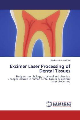 Manickam |  Excimer Laser Processing of Dental Tissues | Buch |  Sack Fachmedien