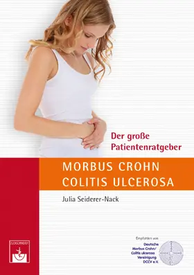 Seiderer-Nack |  Der große Patientenratgeber Morbus Crohn und Colitis ulcerosa | eBook | Sack Fachmedien