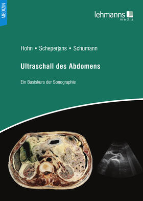 Hohn / Scheperjans / Schumann |  Ultraschallanatomie des Abdomens | eBook | Sack Fachmedien
