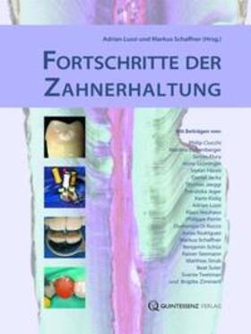Lussi / Schaffner |  Fortschritte der Zahnerhaltung | Buch |  Sack Fachmedien