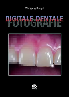 Bengel |  Digitale Dentale Fotografie | eBook | Sack Fachmedien