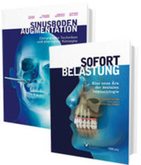 Testori / Galli / del Fabbro |  Sinusbodenaugmentation und Sofortbelastung | Buch |  Sack Fachmedien
