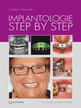 Sliwowski |  Implantologie Step by Step | Buch |  Sack Fachmedien
