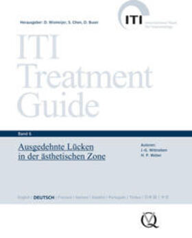 Wismeijer / Chen / Buser |  ITI Treatment Guide Band 6 | Buch |  Sack Fachmedien