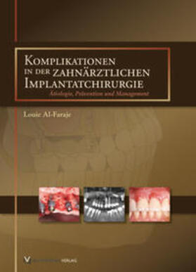 Al-Faraje |  Komplikationen in der zahnärztlichen Implantatchirurgie | Buch |  Sack Fachmedien