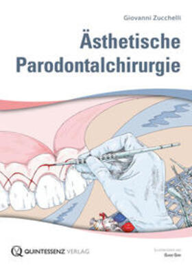 Zucchelli |  Ästhetische Parodontalchirurgie | Buch |  Sack Fachmedien
