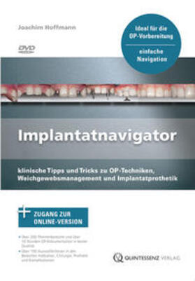 Hoffmann |  Hoffmann, J: Implantatnavigator | Sonstiges |  Sack Fachmedien