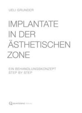 Grunder |  Implantate in der ästhetischen Zone | Buch |  Sack Fachmedien