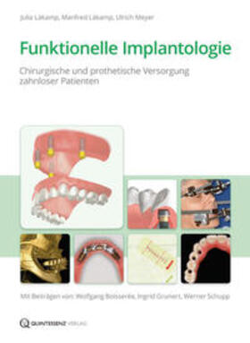 Läkamp / Meyer |  Läkamp, J: Funktionelle Implantologie | Buch |  Sack Fachmedien