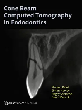 Patel / Harvey / Shemesh |  Cone Beam Computed Tomography in Endodontics | eBook | Sack Fachmedien