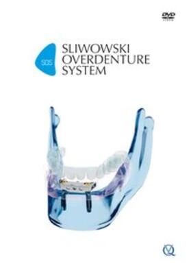 Sliwowski |  SOS - Sliwowski Overdenture System | Sonstiges |  Sack Fachmedien