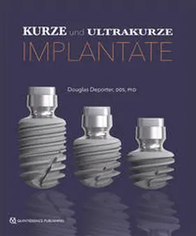 Deporter |  Kurze und ultrakurze Implantate | Buch |  Sack Fachmedien