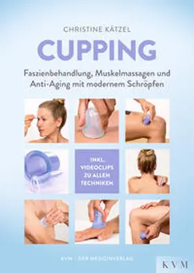 Kätzel |  Cupping | eBook | Sack Fachmedien