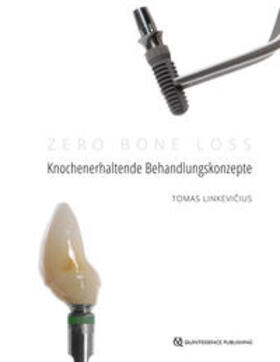 Linkevicius / Linkevicius |  Zero Bone Loss: Knochenerhaltende Behandlungskonzepte | eBook | Sack Fachmedien