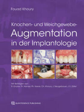 Khoury |  Knochen- und Weichgewebeaugmentation in der Implantologie | Buch |  Sack Fachmedien