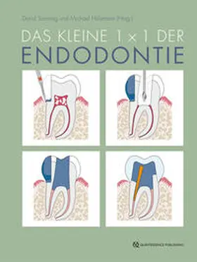 Sonntag / Hülsmann |  Das kleine 1x1 der Endodontie | Buch |  Sack Fachmedien