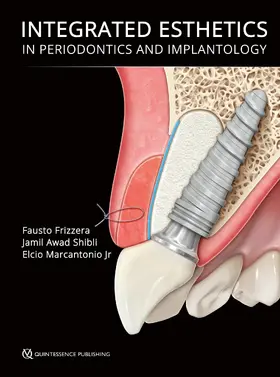 Frizzera / Shibli / Marcantonio |  Integrated Esthetics in Periodontics and Implantology | eBook | Sack Fachmedien