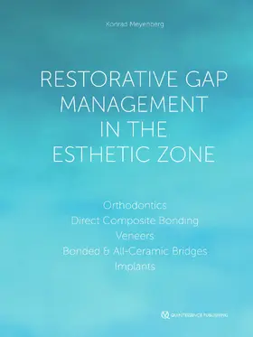 Meyenberg |  Restorative Gap Management in the Esthetic Zone | eBook | Sack Fachmedien