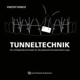 Ronco |  Tunneltechnik | Buch |  Sack Fachmedien