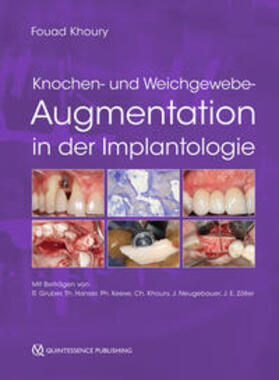 Khoury |  Knochen- und Weichgewebeaugmentation in der Implantologie | eBook | Sack Fachmedien