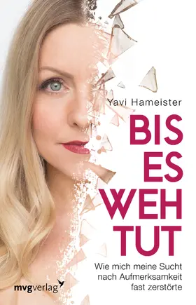 Hameister |  Bis es wehtut | Buch |  Sack Fachmedien