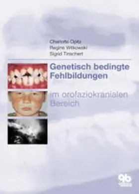 Opitz / Witkowski / Tinschert |  Genetisch bedingte Fehlbildungen im orofaziokranialen Bereich | Buch |  Sack Fachmedien