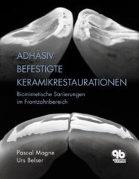 Belser / Magne |  Adhäsiv befestigte Keramikrestaurationen im Frontzahnbereich | Buch |  Sack Fachmedien