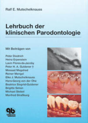 Mutschelknauß |  Lehrbuch der klinischen Parodontologie | Buch |  Sack Fachmedien