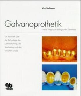 Wirz / Hoffmann |  Galvanoprothetik | Buch |  Sack Fachmedien