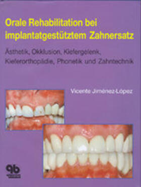 Jiménez-López |  Orale Rehabilitation bei implantatgestütztem Zahnersatz | Buch |  Sack Fachmedien