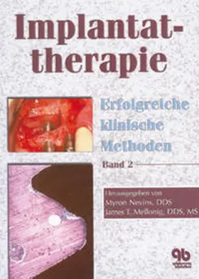 Mellonig / Nevins |  Implantattherapie | Buch |  Sack Fachmedien